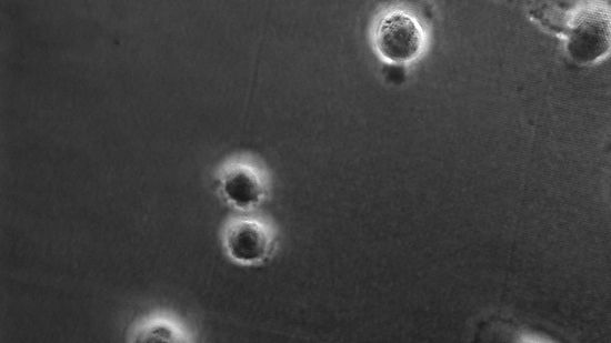 MDA-MB-231 cells on transparent VA-SiNW